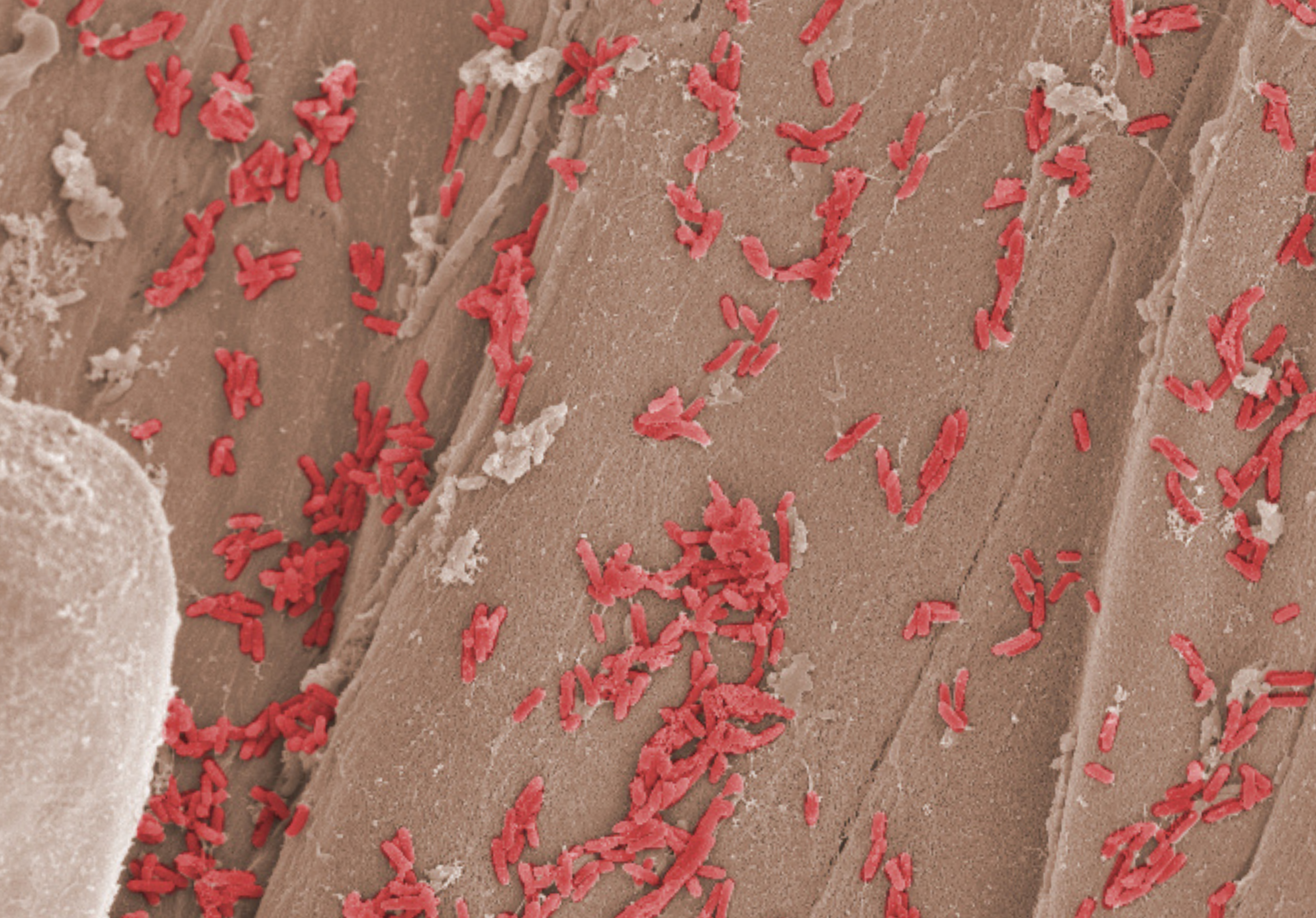 Deep Dive: Bacillus as a Multitool for Modern Ag